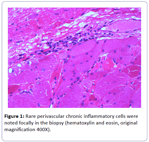 clinical-molecular-pathology-Rare-perivascular