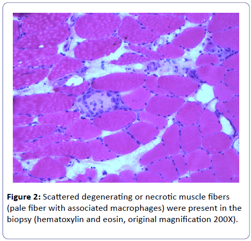 clinical-molecular-pathology-Scattered-degenerating