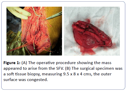 clinical-molecular-pathology-operative-procedure