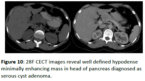 clinical-radiology-CECT-images