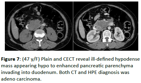 clinical-radiology-HPE-diagnosis