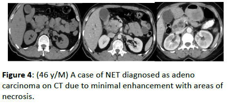 clinical-radiology-NET-diagnosed