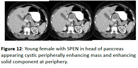 clinical-radiology-Young-female