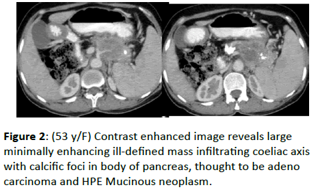 clinical-radiology-calcific-foci