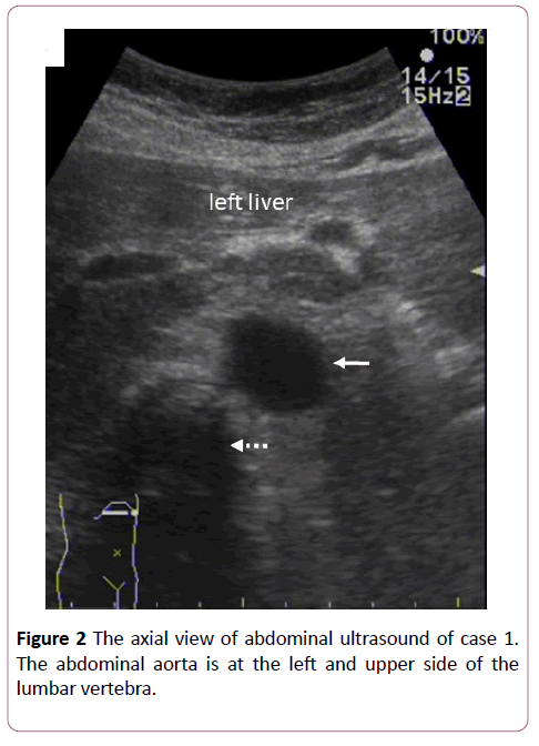 clinical-radiology-case-reports-abdominal