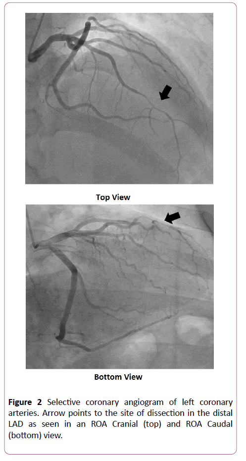 clinical-radiology-case-reports-angiogram