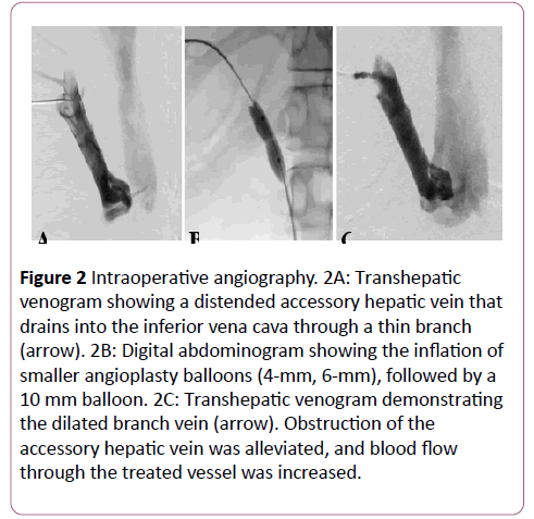 clinical-radiology-case-reports-angiography