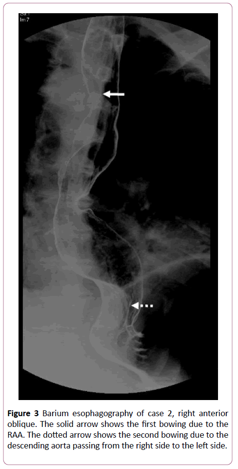 clinical-radiology-case-reports-anterior