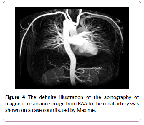 clinical-radiology-case-reports-aortography