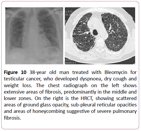 clinical-radiology-case-reports-cancer