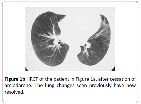 clinical-radiology-case-reports-cessation