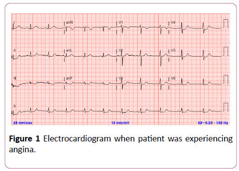 clinical-radiology-case-reports-electrocardiogram