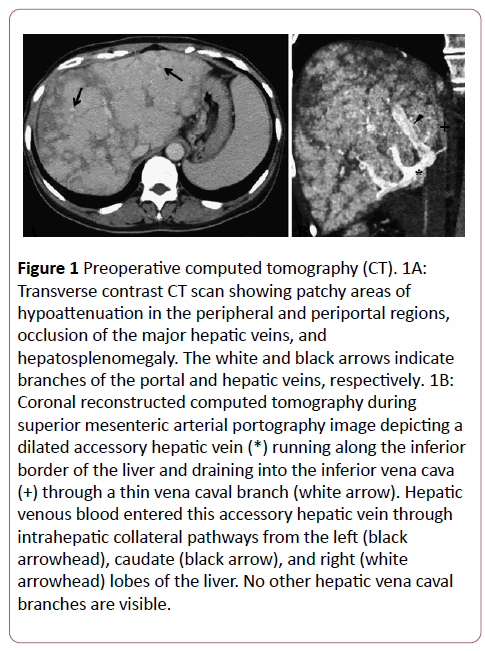 clinical-radiology-case-reports-hypoattenuation