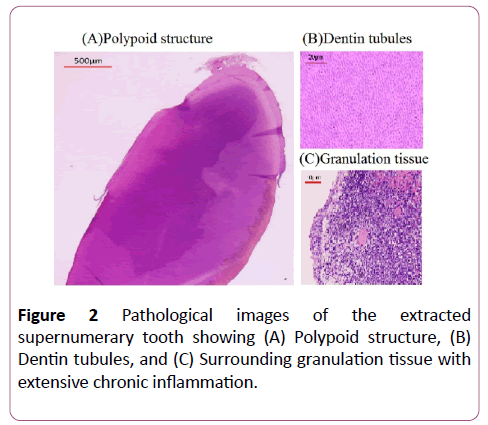 clinical-radiology-case-reports-pathological