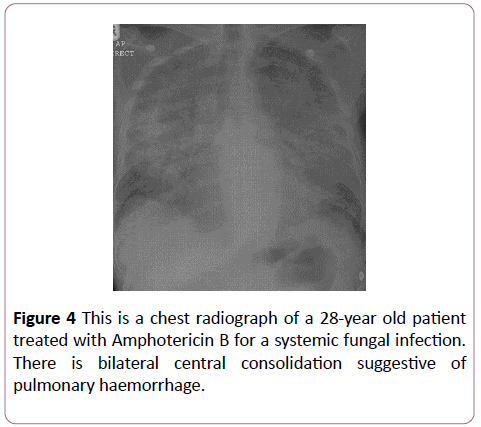 clinical-radiology-case-reports-radiograph