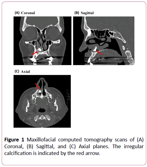clinical-radiology-case-reports-tomography