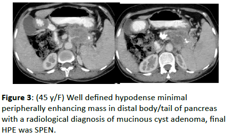 clinical-radiology-distal-body