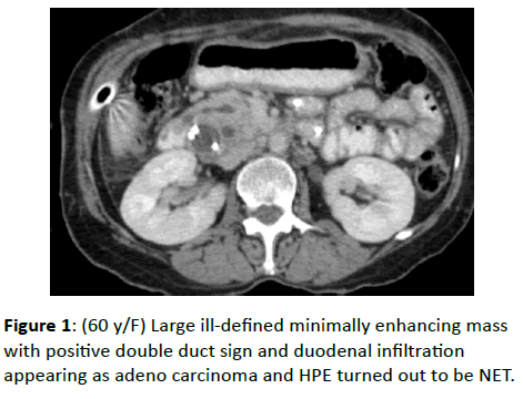 clinical-radiology-duct-sign