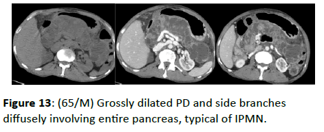 clinical-radiology-entire-pancreas