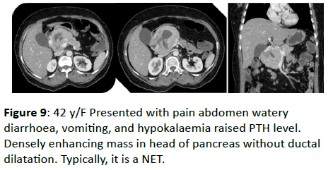 clinical-radiology-pain-abdomen