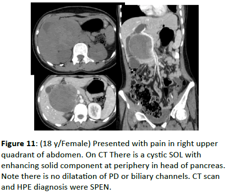 clinical-radiology-right-upper