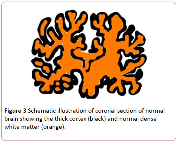 congenital-diseases-Schematic-illustration