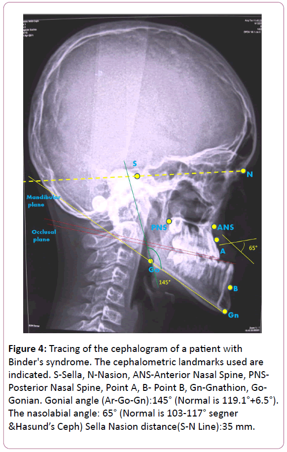 congenital-diseases-cephalometric-landmarks