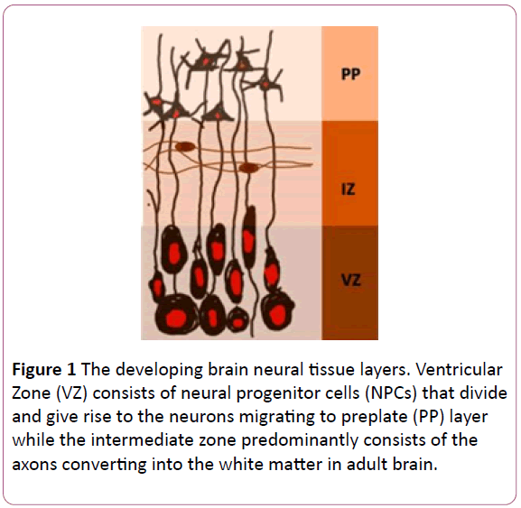 congenital-diseases-neural-tissue-layers