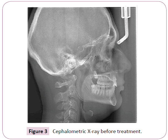 dental-craniofacial-research-Cephalometric-X-ray-treatment