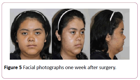 dental-craniofacial-research-Facial-photographs