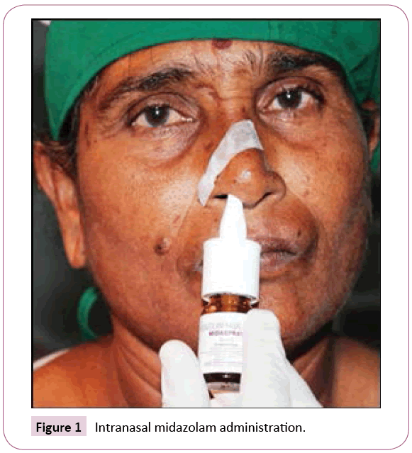 dental-craniofacial-research-Intranasal-midazolam