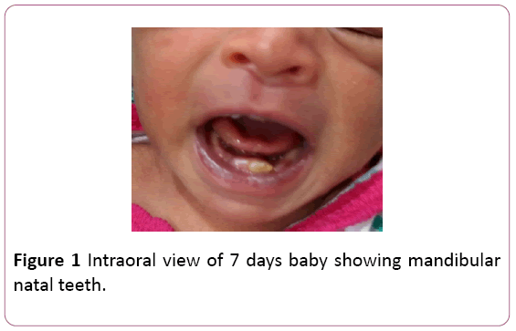 dental-craniofacial-research-Intraoral-viewt