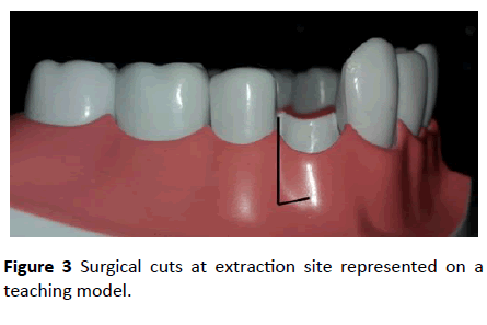 dental-craniofacial-research-Surgical-cuts