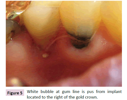 dental-craniofacial-research-White-bubble