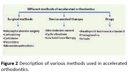 dental-craniofacial-research-accelerated-orthodontics