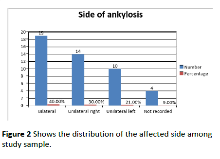 dental-craniofacial-research-affected-side-among