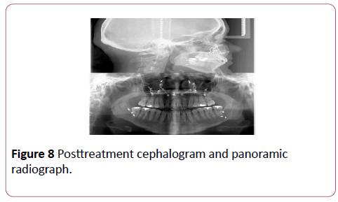 dental-craniofacial-research-cephalogram