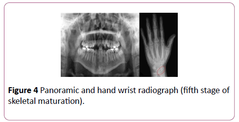 dental-craniofacial-research-hand-wrist