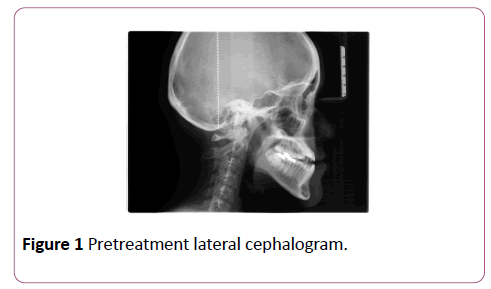 dental-craniofacial-research-lateral-cephalogram