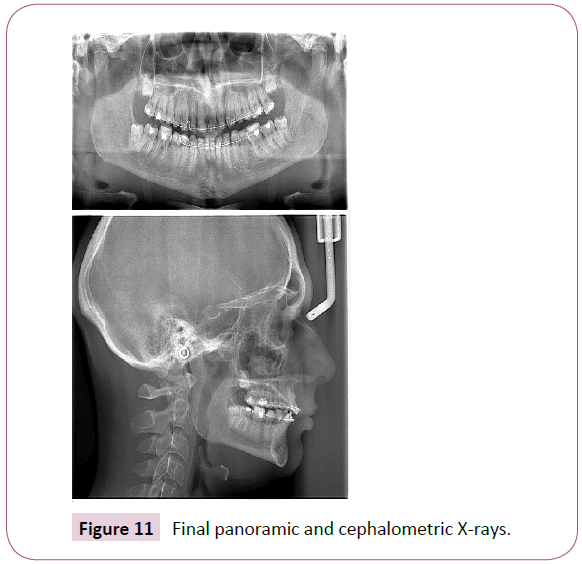 dental-craniofacial-research-panoramic-cephalometric-X-rays