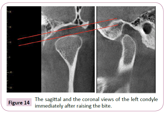 dental-craniofacial-research-sagittal-coronal-condyle