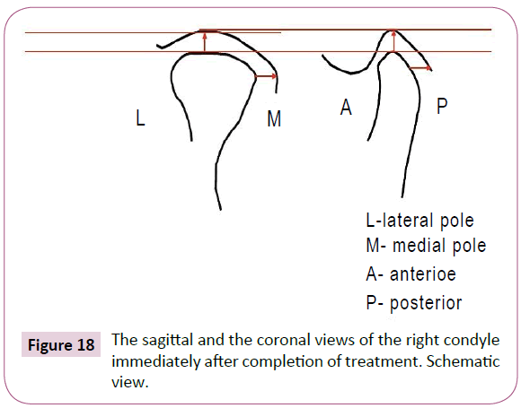 dental-craniofacial-research-sagittal-coronal-condyle