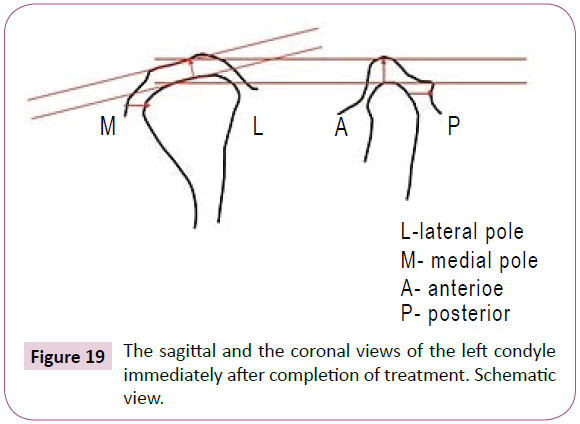 dental-craniofacial-research-sagittal-coronal-condyle