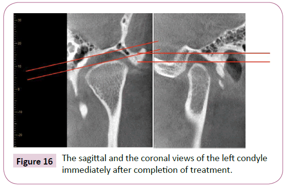 dental-craniofacial-research-sagittal-immediately-completion