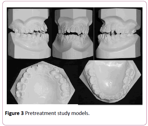 dental-craniofacial-research-study-models