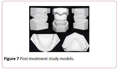 dental-craniofacial-research-study-models