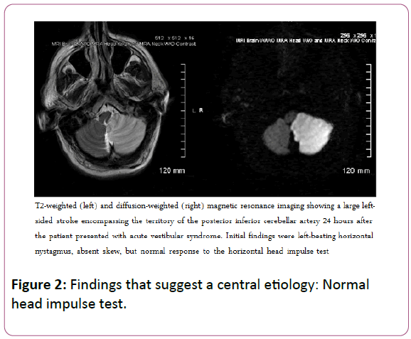 ear-nose-throat-central-etiology