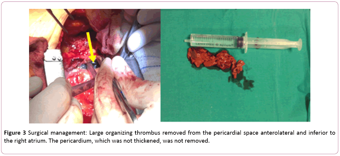 emergency-internal-medicine-Surgical-management