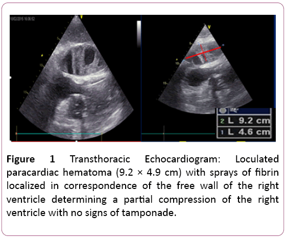 emergency-internal-medicine-Transthoracic-Echocardiogram