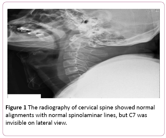 emergency-internal-medicine-cervical-spine